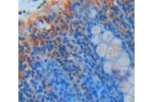 IHC-P analysis of Kidney tissue, with DAB staining. (Amyloid beta (A4) Precursor Protein-Binding, Family B, Member 1 Interacting Protein (APBB1IP) (AA 188-421) antibody)