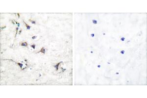 Peptide - +Immunohistochemical analysis of paraffin-embedded human brain tissue using Ezrin antibody (#C0186). (Ezrin antibody)