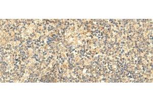 Immunohistochemistry of paraffin-embedded Human tonsil tissue using NTAN1 Polyclonal Antibody at dilution of 1:50(x200) (NTAN1 antibody)