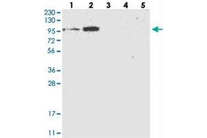 Western blot analysis of Lane 1: RT-4, Lane 2: U-251 MG, Lane 3: Human Plasma, Lane 4: Liver, Lane 5: Tonsil with FLJ22374 polyclonal antibody . (FAM188B antibody)