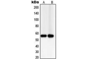 Western blot analysis of TXNRD2 expression in PC12 (A), Jurkat (B) whole cell lysates.