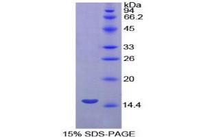 SDS-PAGE (SDS) image for Uromodulin (UMOD) (AA 32-151) protein (His tag) (ABIN1171598)