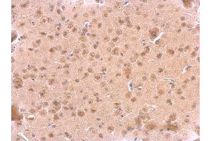 IHC-P Image ARF3 antibody detects ARF3 protein at cytosol on mouse fore brain by immunohistochemical analysis. (ARF3 antibody)