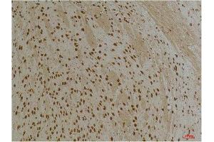 KCNH1 antibody