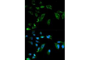 Immunofluorescence analysis of HeLa cell using NEK8 antibody. (NEK8 antibody  (AA 1-300))