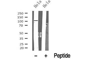 Western blot analysis of PRK1/2 in lysates of Hela? (PRK1/2 antibody)