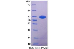 SDS-PAGE analysis of Rat Lipase, Pancreatic Protein. (Lipase Protein)