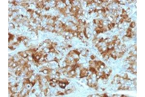 Formalin-fixed, paraffin-embedded adrenal gland stained with Chromogranin A antibody cocktail (Chromogranin A antibody)