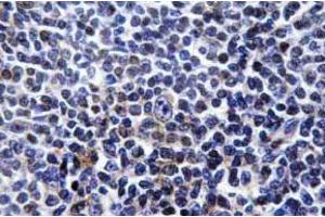 Immunohistochemistry (IHC) analyzes of p-Paxillin (pTyr31) antibody in paraffin-embedded human tonsil tissue. (Paxillin antibody  (pTyr31))