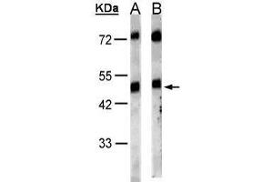 WB Image Sample(30 μg of whole cell lysate) A:HeLa S3, B:MOLT4, 10% SDS PAGE antibody diluted at 1:1000 (GRPR antibody)