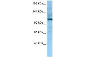 Image no. 1 for anti-MORC Family CW-Type Zinc Finger 4 (MORC4) (AA 747-796) antibody (ABIN6748258) (MORC4 antibody  (AA 747-796))