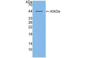 Western blot analysis of recombinant Mouse ADAM8. (ADAM8 antibody  (AA 145-493))