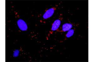 Proximity Ligation Assay (PLA) image for anti-Mdm2, p53 E3 Ubiquitin Protein Ligase Homolog (Mouse) (MDM2) (AA 101-200) antibody (ABIN517806)