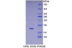 SDS-PAGE of Protein Standard from the Kit (Highly purified E. (KRT15 ELISA Kit)