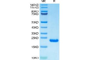 PTP4A2 Protein (AA 1-164) (His tag)