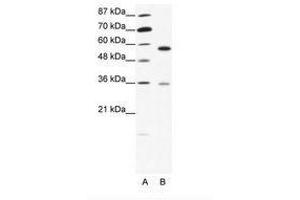 Image no. 1 for anti-GDP Dissociation Inhibitor 1 (GDI1) (C-Term) antibody (ABIN202545) (GDI1 antibody  (C-Term))