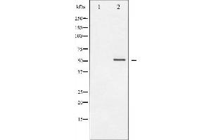 Western blot analysis of Vimentin phosphorylation expression in Nocodazole treated A549 whole cell lysates,The lane on the left is treated with the antigen-specific peptide. (Vimentin antibody  (pSer56))
