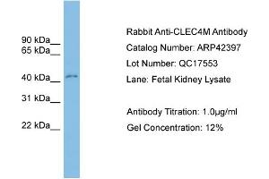 WB Suggested Anti-CLEC4M Antibody Titration:  0. (C-Type Lectin Domain Family 4, Member M (CLEC4M) (Middle Region) antibody)