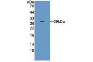 Detection of Recombinant SEMA5B, Human using Monoclonal Antibody to Semaphorin 5B (SEMA5B) (SEMA5B antibody  (AA 350-602))