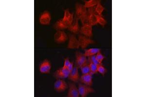 Immunofluorescence analysis of MCF7 cells using CDKN3 Rabbit pAb (ABIN3022821, ABIN3022822, ABIN3022823, ABIN1512750 and ABIN6219244) at dilution of 1:100 (40x lens). (CDKN3 antibody  (AA 1-172))
