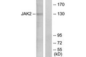 Western blot analysis of extracts from HT-29 cells, using JAK2 (Ab-1007) Antibody.