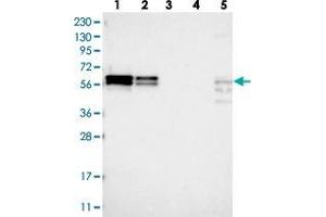 Western blot analysis of Lane 1: RT-4, Lane 2: U-251 MG, Lane 3: Human Plasma, Lane 4: Liver, Lane 5: Tonsil with ZC3H15 polyclonal antibody . (ZC3H15 antibody)