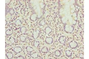 Immunohistochemistry of paraffin-embedded human small intestine tissue using ABIN7168517 at dilution of 1:100 (SCAPER antibody  (AA 1109-1400))