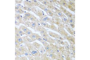 Immunohistochemistry of paraffin-embedded human liver using UCHL3 antibody at dilution of 1:100 (40x lens). (UCHL3 antibody)