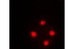 Immunofluorescent analysis of SRSF5 staining in HeLa cells. (SRSF5 antibody)