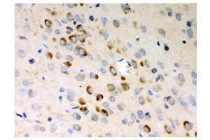 IHC analysis of Stathmin 1 using anti-Stathmin 1 antibody (ABIN3043301). (Stathmin 1 antibody  (N-Term))