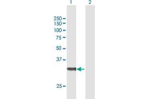 Western Blot analysis of ZFAND3 expression in transfected 293T cell line by ZFAND3 MaxPab polyclonal antibody. (ZFAND3 antibody  (AA 1-227))