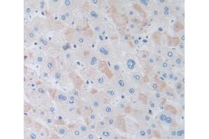 Figure. (GSTK1 antibody  (AA 7-222))