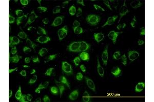 Immunofluorescence of monoclonal antibody to ACOT9 on HeLa cell. (ACOT9 antibody  (AA 1-212))