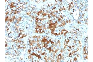Formalin-fixed, paraffin-embedded human Adrenal Gland stained with Chromogranin A Monoclonal Antibody (CHGA/765). (Chromogranin A antibody)