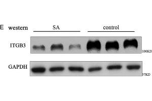 The expressions of H19 and integrin β3 (ITGB3) decrease in human embryonic chorion tissue of spontaneous abortion. (GAPDH antibody)