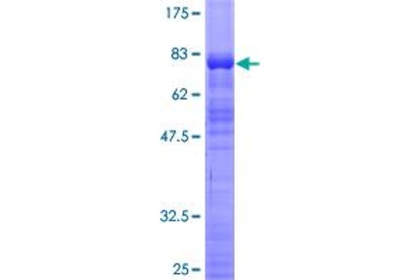 ZSCAN21 Protein (GST tag)