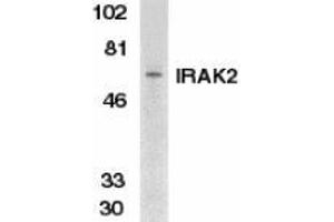 Western blot analysis of IRAK2 in K562 whole cell lysate with AP30441PU-N IRAK2 antibody at 1/500 dilution.