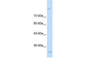 WB Suggested Anti-MPPED2 Antibody Titration:  0. (MPPED2 antibody  (C-Term))