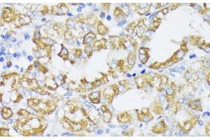 Immunohistochemistry of paraffin-embedded Human stomach using SLC30A1 Polyclonal Antibody at dilution of 1:100 (40x lens).
