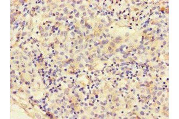 FAT Atypical Cadherin 2 (FAT2) (AA 123-314) antibody