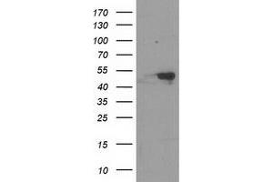 HEK293T cells were transfected with the pCMV6-ENTRY control (Left lane) or pCMV6-ENTRY RBBP7 (Right lane) cDNA for 48 hrs and lysed. (RBBP7 antibody)