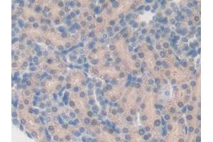 DAB staining on IHC-P; Samples: Rat Kidney Tissue (CYP27B1 antibody  (AA 251-500))