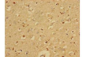 Immunohistochemistry of paraffin-embedded human brain tissue using ABIN7163532 at dilution of 1:100 (PAI1 antibody  (AA 24-398))