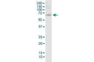 Western Blotting (WB) image for anti-PHD Finger Protein 1 (PHF1) (AA 2-100) antibody (ABIN518847)