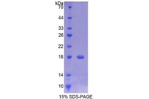 SDS-PAGE (SDS) image for Transmembrane Protein 27 (TMEM27) (AA 15-141) protein (His tag) (ABIN4990899)