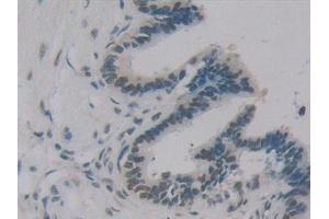 Immunohistochemistry (IHC) image for anti-Insulin-Like Growth Factor Binding Protein 1 (IGFBPI) (AA 36-235) antibody (ABIN7442780)