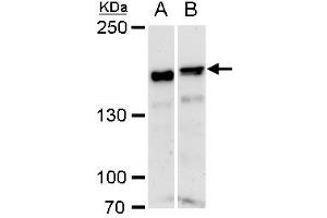 ROCK1 antibody  (N-Term)