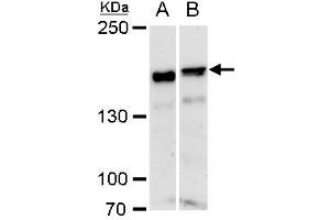 WB Image ROCK1 antibody [N1N2], N-term detects ROCK1 protein by western blot analysis.