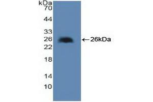 Western blot analysis of recombinant Human cPLA2. (PLA2G4A antibody  (AA 1-178))