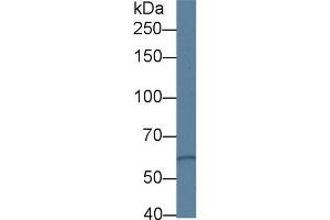 Western Blot; Sample: Human Hela cell lysate; Primary Ab: 1µg/ml Rabbit Anti-Human PKD3 Antibody Second Ab: 0. (PRKD3 antibody  (AA 576-832))